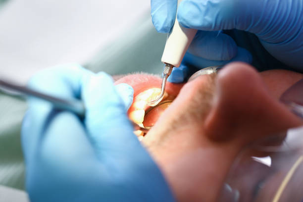 Best Emergency Dental Surgery in Delshire, OH