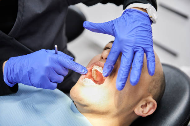 Best Emergency Broken Tooth Repair in Delshire, OH